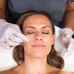 3 Series Chemical Peel at Rise Collective Medspa in New Braunfels, TX