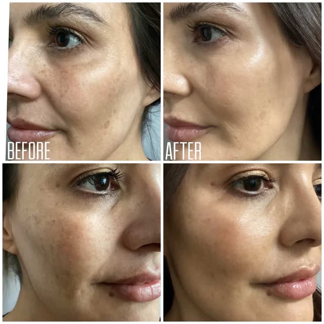 💫 The Better Glow-up at Rise Collective Medspa in New Braunfels, TX